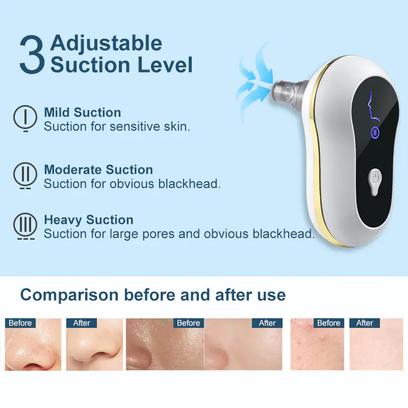 ✨ GlowPore™ Blackhead Remover Vacuum by CurvaGlow™