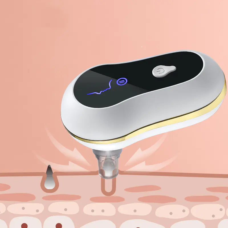 ✨ GlowPore™ Blackhead Remover Vacuum by CurvaGlow™