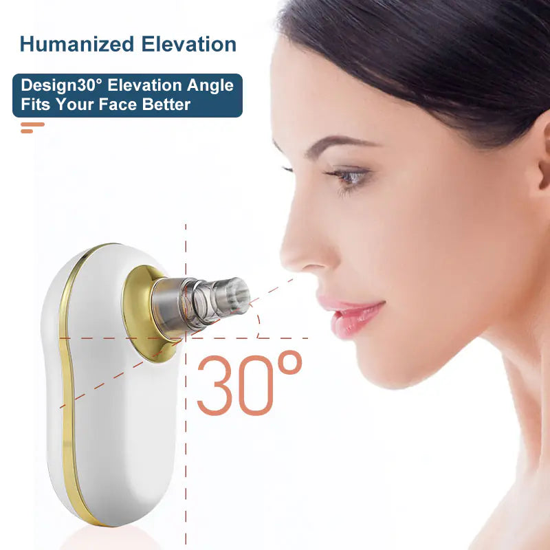 ✨ GlowPore™ Blackhead Remover Vacuum by CurvaGlow™