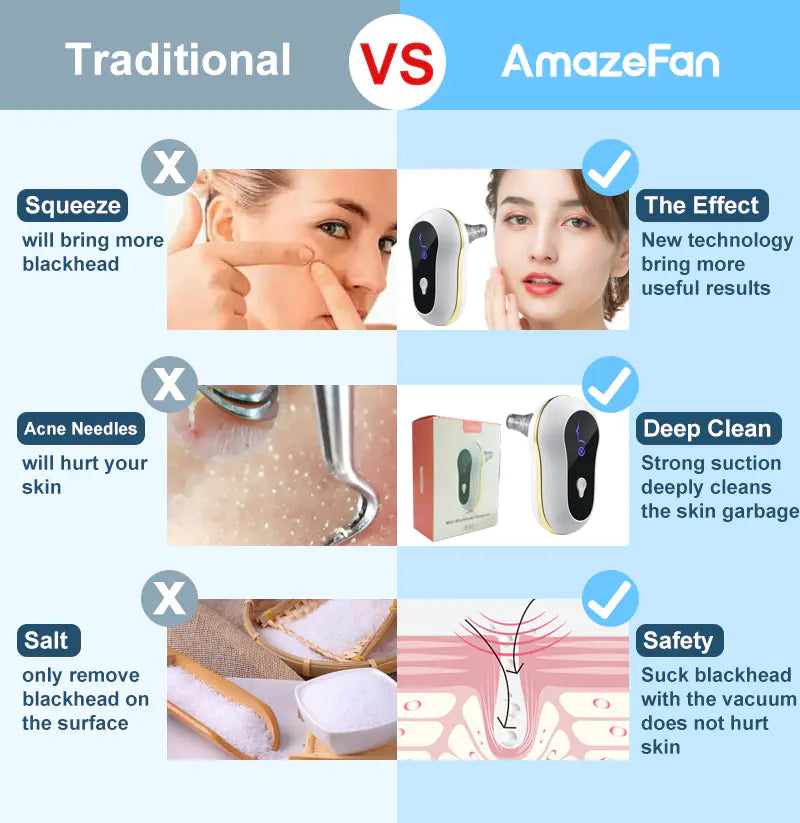 ✨ GlowPore™ Blackhead Remover Vacuum by CurvaGlow™